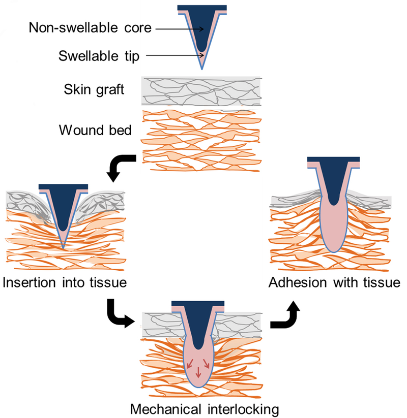 Illustration for article titled Doctors keep skin grafts in place using parasitic worms